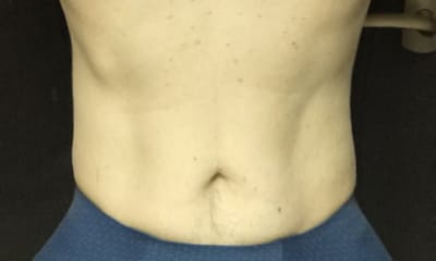 わたしの腹筋強化計画（2025.12月3週目）