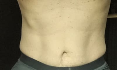 わたしの腹筋強化計画（2026.3月1週目）